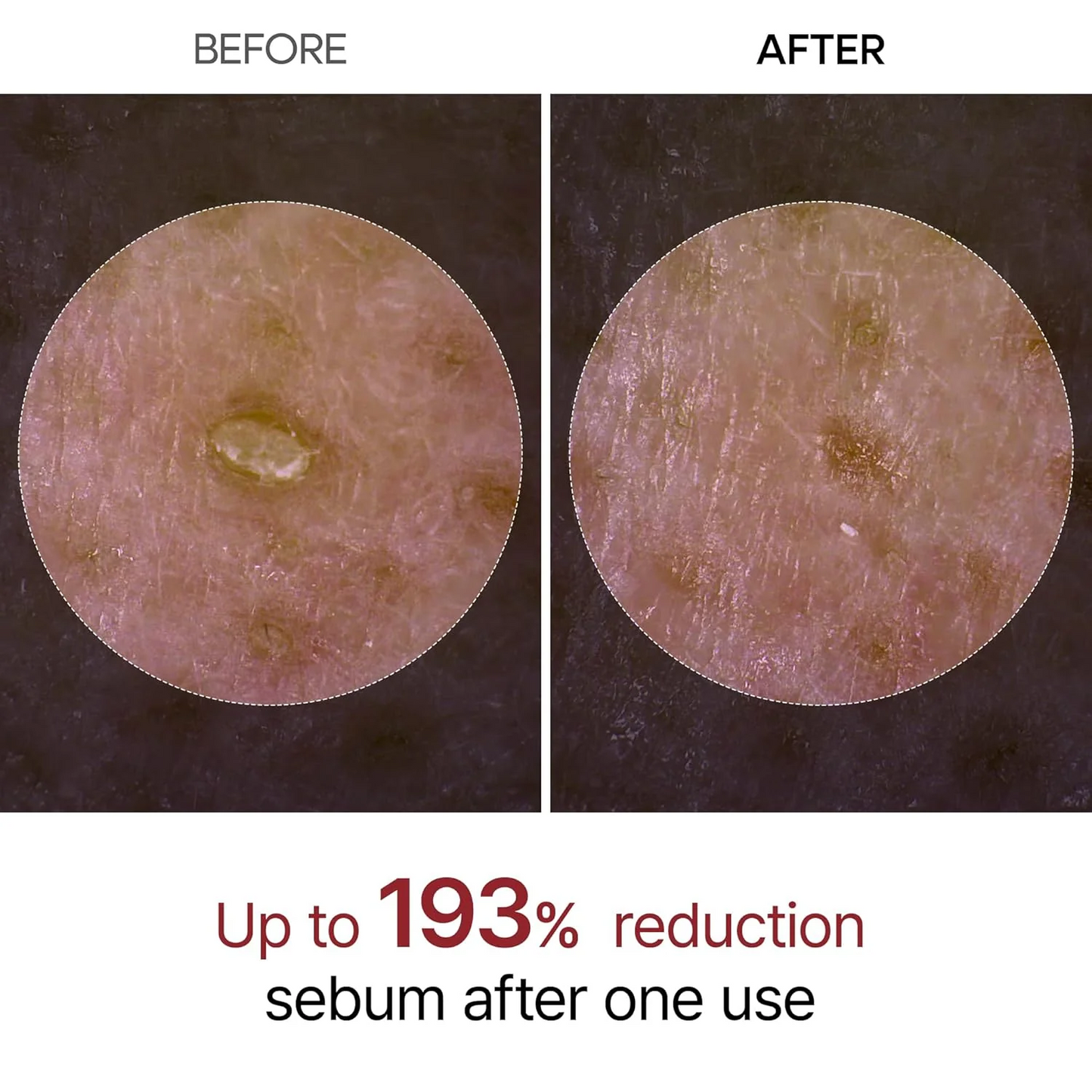 Radiant Glow Rice Peeling Ampoule™