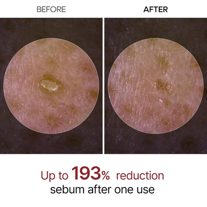 Radiant Glow Rice Peeling Ampoule™